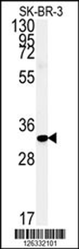 FAM92A1 Antibody (Center)