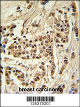 TTPAL Antibody (C-term)