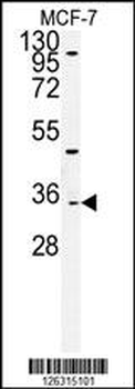 TTPAL Antibody (C-term)