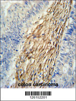 ELP6 Antibody (C-term)