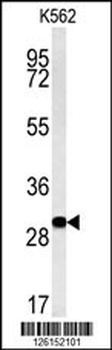 ELP6 Antibody (C-term)