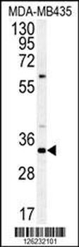 SGF29 Antibody (C-term)