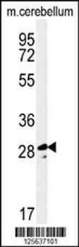 TESC Antibody (C-term)