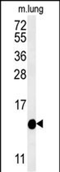 IFT20 Antibody (Center)