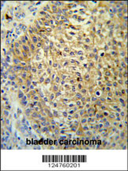 TM222 Antibody (Center)