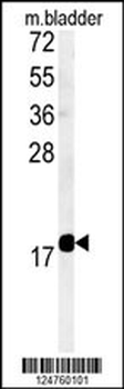 TM222 Antibody (Center)