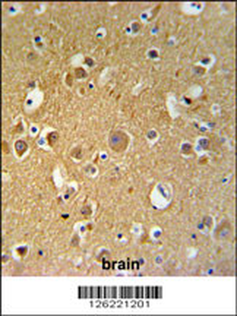 TUBB2C Antibody (Center)