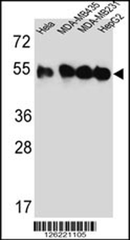 TUBB2C Antibody (Center)