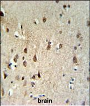 HEL308 Antibody (Center)