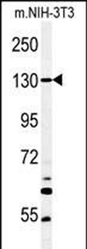 HEL308 Antibody (Center)