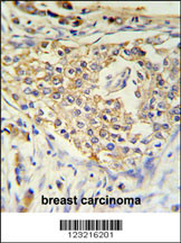 ADFP Antibody (Center)