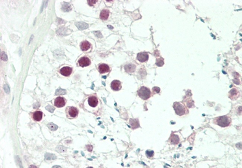 JHDM1D Antibody (Center)