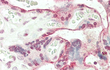 JHDM1D Antibody (Center)