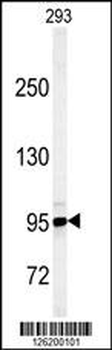 JHDM1D Antibody (Center)
