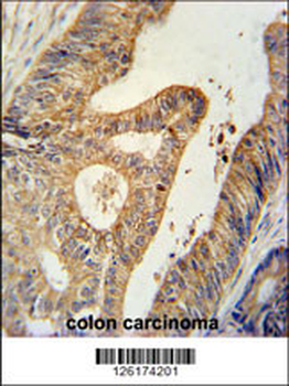 BTG1 Antibody (Center)