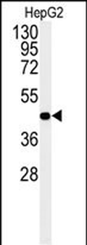 NR5A1 Antibody (N-term)