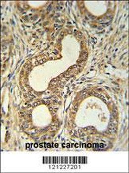 Roundabout 4 Antibody (N-term)