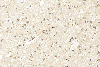 LINGO-1(LRRN6A)-S596 (C-term) Antibody