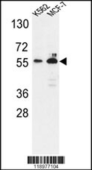 G6PD Antibody (Center)