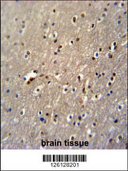 GLD2 Antibody (N-term)