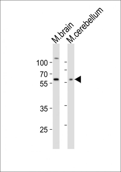 GLD2 Antibody (N-term)