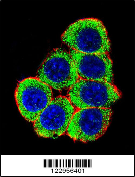 XRCC6 Antibody (Center)