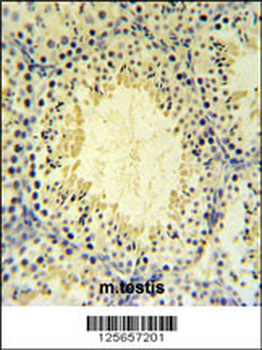 UBXN6 Antibody (C-term)
