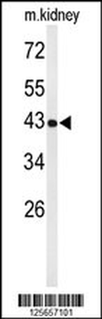 UBXN6 Antibody (C-term)