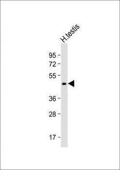 UBXN6 Antibody (C-term)
