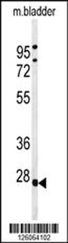 TPRGL Antibody (N-term)