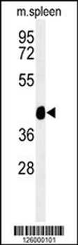 TEKT4 Antibody (Center)