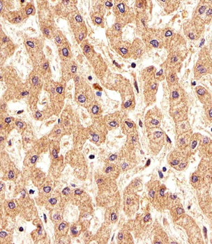 PSMAL Antibody (Center)