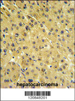 PSMAL Antibody (Center)