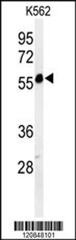 PSMAL Antibody (Center)