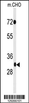 PHF13 Antibody (C-term)