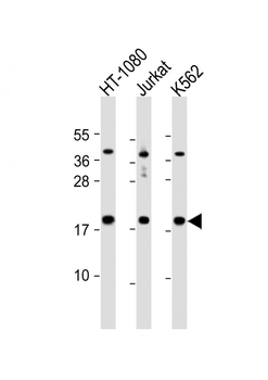 NAT13 Antibody (C-term)