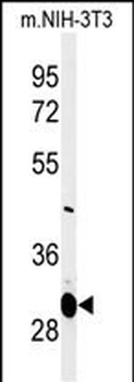 MAGT1 Antibody (N-term)
