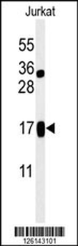 LIMD2 Antibody (N-term)