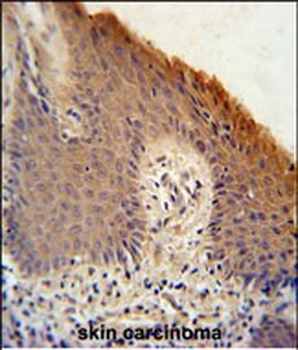KRTAP1-1 Antibody (Center)