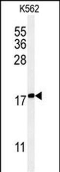 KRTAP1-1 Antibody (Center)
