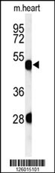KRT82 Antibody (Center)