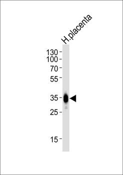 FOLR2 Antibody (N-term)