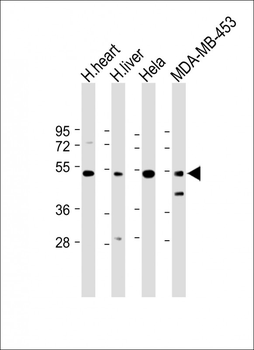 FBXL2 Antibody (C-term)