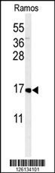 CMTM7 Antibody (N-term)