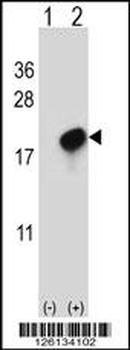 CMTM7 Antibody (N-term)