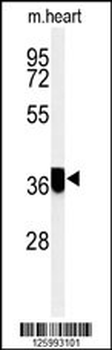 CCDC42 Antibody (Center)