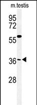 CCD92 Antibody (Center)