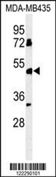 BTNL8 Antibody (Center)