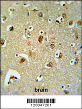 B3GALT6 Antibody (C-term)