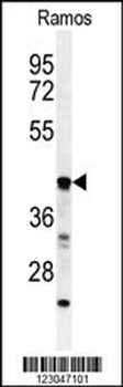 B3GALT6 Antibody (C-term)